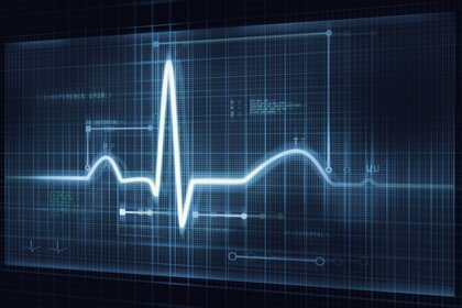 ECG Trace