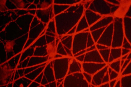 neurons