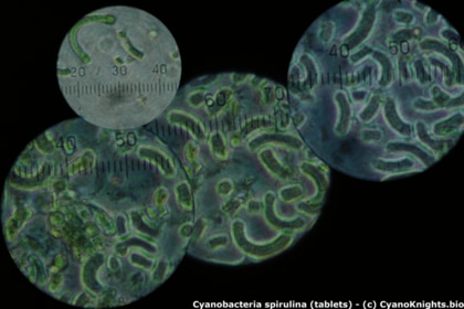 cyanobacteria