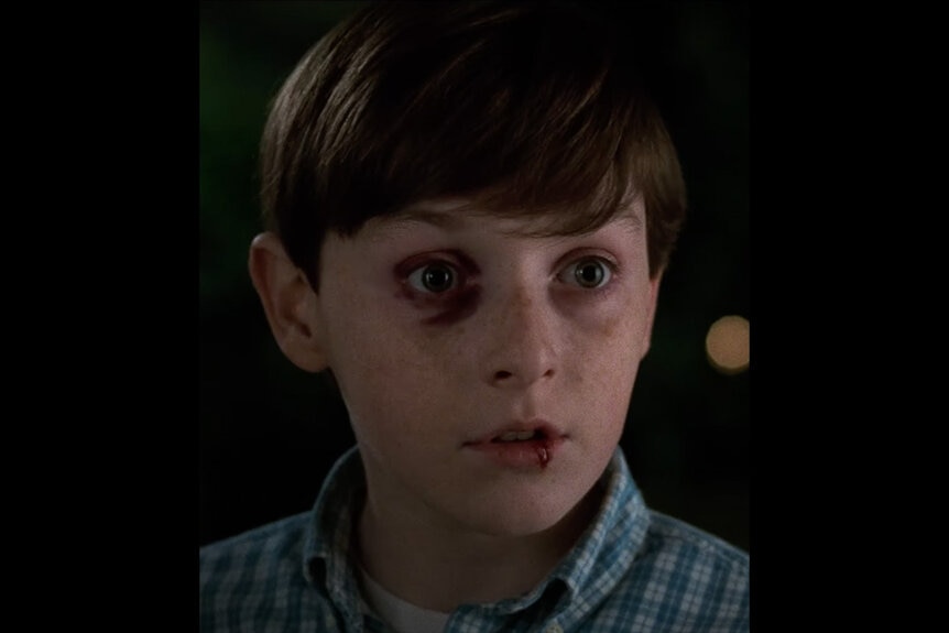 Young Alan (Adam Hann-Byrd) appears with a black eye and busted lip in Jumanji (1995).